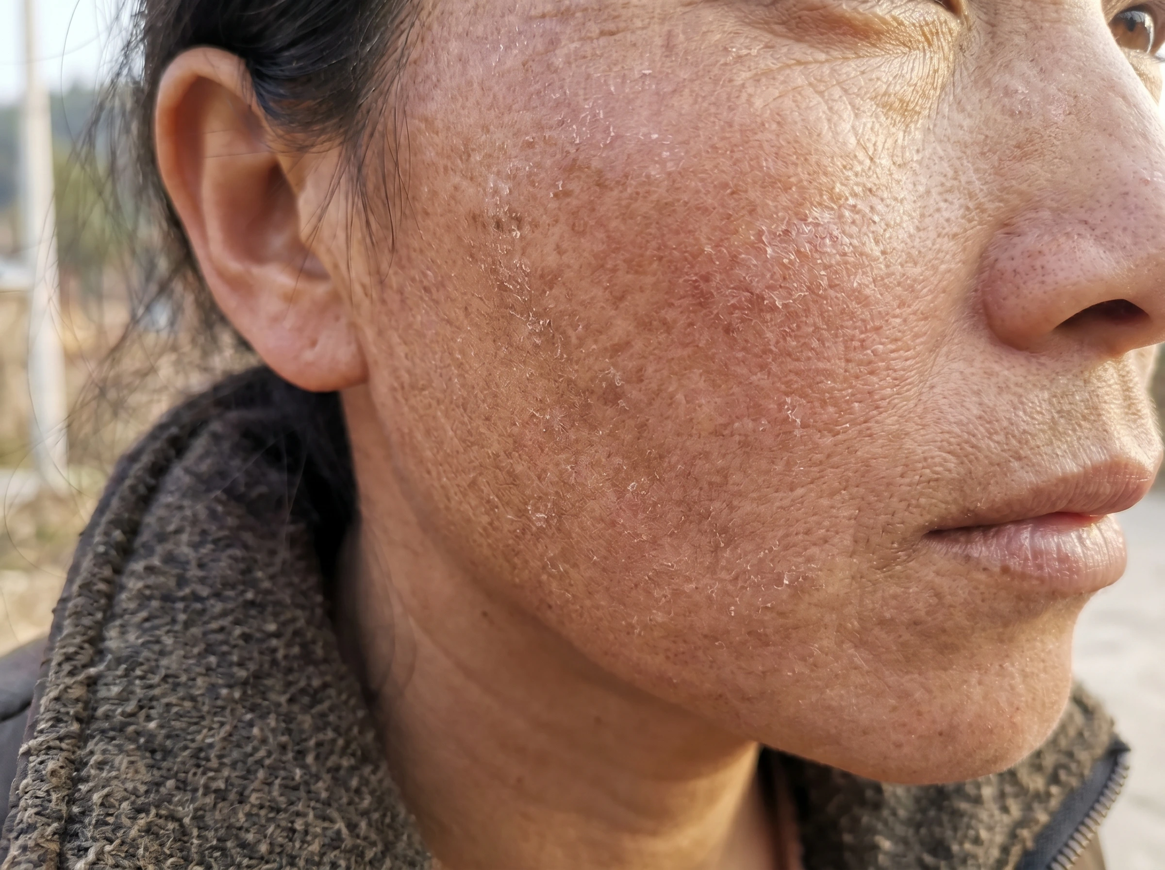 Before damaged skin